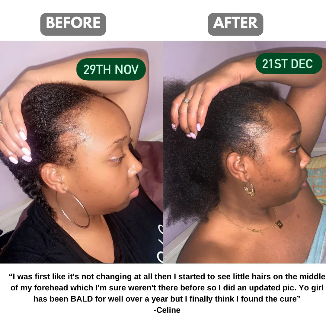 BATANA NATURAL HAIR GROWTH OIL
