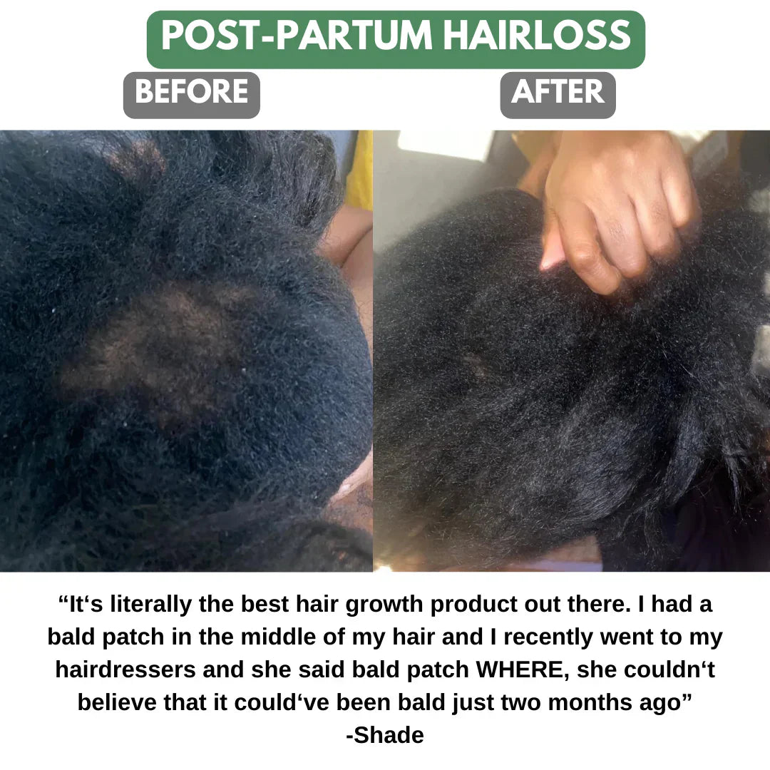 BATANA NATURAL HAIR GROWTH OIL