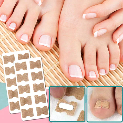 NailPatches™ | Correction patches for beautiful and healthy nails